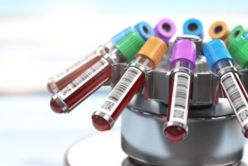 blood-test-tubes-in-centrifuge-plasma-preparation-2021-08-26-16-57-05-utc copy